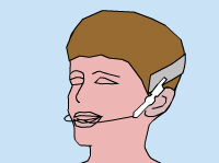 Drawing of a man wearing an orthodontic headgear