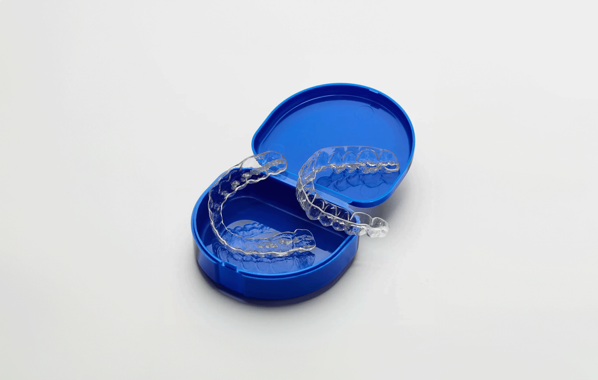 Essix Retainers in a blue plastic box